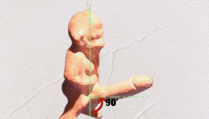 After penile erectile Angle with the ground