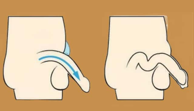 normal length of penis